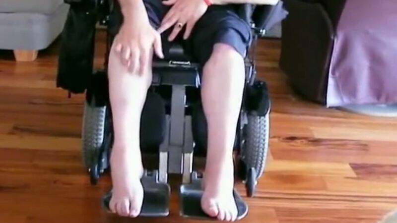 Myopathy: What is it, why does it develop and how does muscle disease manifest?