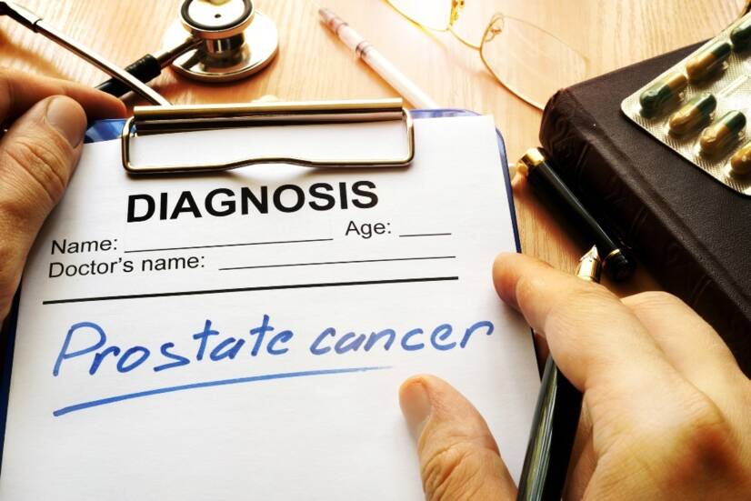 Prostate Cancer: Causes, Symptoms, Prognosis of Treatment