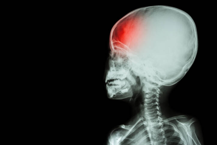 How to recognize a concussion in children? How does it manifest itself and why to be alert?