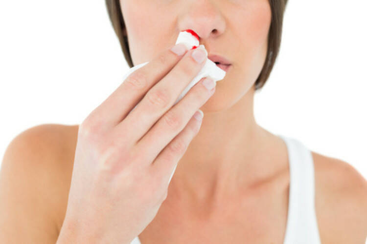 Nosebleeds. What are the most common causes and how to stop it?