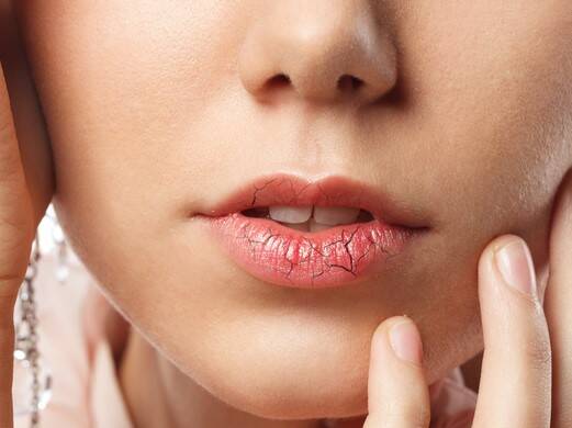 Chapped lips: why are my lips dry and chapped?