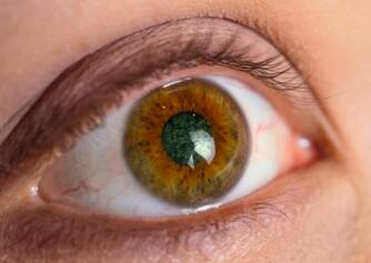 Glaucoma or glaucoma: what are its causes, symptoms and treatment?