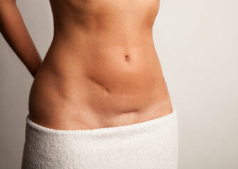 What is hernia, abdominal rupture? What are its causes, symptoms and treatment?