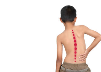 Scoliosis in Children and Adults: Causes, Manifestations and Treatment