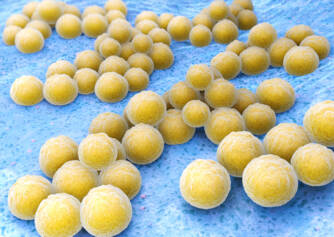 Golden staph: What is it, transmission, symptoms and treatment. How to protect yourself?