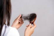 Alopecia (a condition of reduced hair quantity): what are its causes and symptoms?