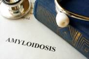 Amyloidosis: what is it and why does it arise, what symptoms does it have?
