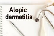 Atopic eczema: what is it, why does it arise and what are its symptoms?