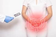 Crohn's disease: what is it, why does it occur and what are its symptoms?