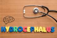 Hydrocephalus: What is it and why does it occur? What are the symptoms and consequences?