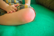 Juvenile idiopathic arthritis: Symptoms of rheumatism, arthritis in children?