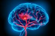 Bleeding in the brain: why does it occur and what are its symptoms?