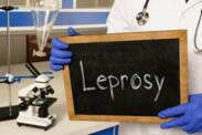 Leprosy: What is leprosy, how does it occur and what are its symptoms?