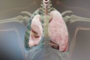 Pneumothorax (air in the chest): causes, symptoms and first aid