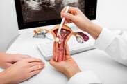 Polyp of the uterus: How does it arise and what are its symptoms? Is it dangerous?