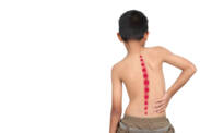 Scoliosis in Children and Adults: Causes, Manifestations and Treatment