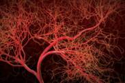 Vasculitis, Causes of Inflamed Blood Vessels, Symptoms
