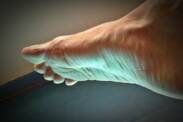 Diabetic foot as a complication of diabetes?