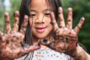 What is dirty hands disease? Dysentery, rubella, dysentery, shigellosis