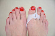 How does hallux valgus occur: bunions? The influence of shoes + treatment and splints