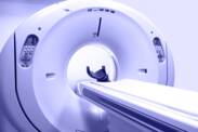 What is MRI and what is it used for?