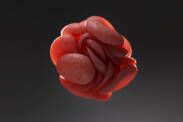 Thrombosis: A disease of the old? It threatens the young too + Causes and manifestations