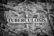 Tuberculosis is not a thing of the past, it kills millions of people every year