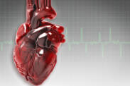 What is life like after a heart attack? Does it limit, cause incapacity for work?