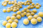 Golden staph: What is it, transmission, symptoms and treatment. How to protect yourself?