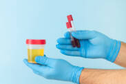 What does blood in the urine, hematuria mean? (invisible, in pregnancy, in children)