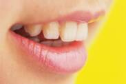 Teeth wobbling: what are the causes (in adults and children)?