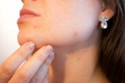 Rash: What are the causes of rashes (even inflamed, red and itchy rashes)?