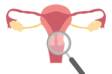 Cervical Cancer: Causes, Symptoms, Prevention